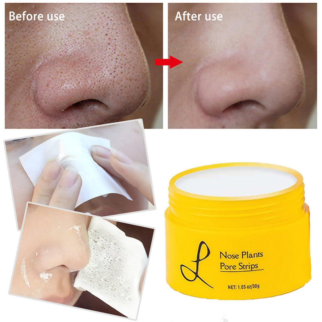 Deep Pore Cleansing Blackhead Removal Strips | Gentle & Effective | 30g