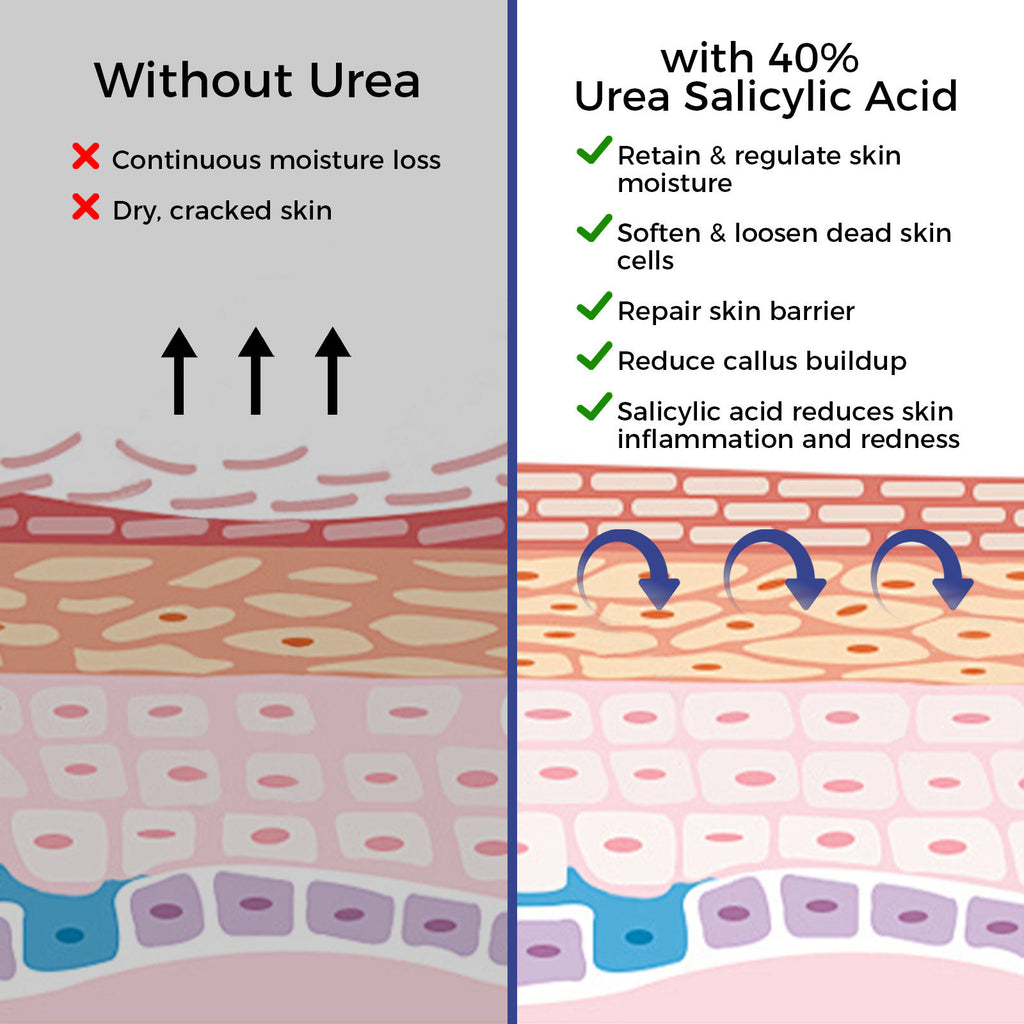 High-Strength Urea Cream – 40% & 42% with Salicylic Acid | Intensive Foot & Hand Repair