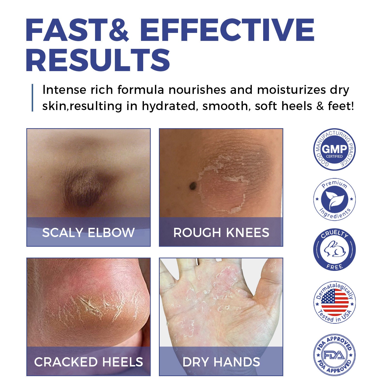 High-Strength Urea Cream – 40% & 42% with Salicylic Acid | Intensive Foot & Hand Repair