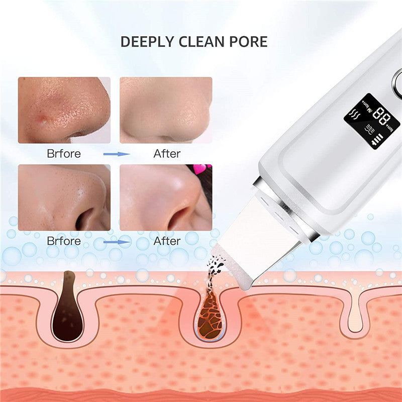 Ultrasonic Skin Scrubber with LCD Display – 4-Mode Deep Pore Cleanser & Blackhead Remover