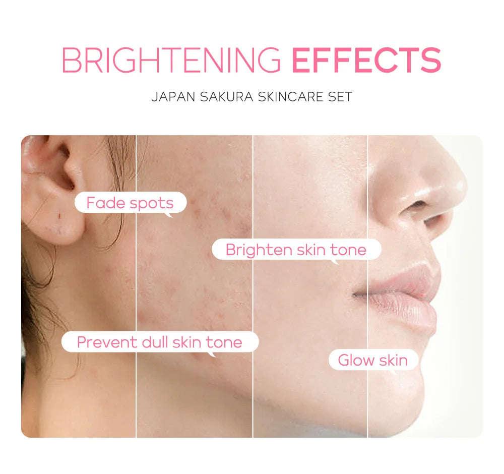 3pcs/set LAIKOU Skin Care Set Vitamin C Sakura Snail Essence Serum & Eye Cream & Face Cream Moisturizer Travel Size Skincare Set Nanasbeautyholic