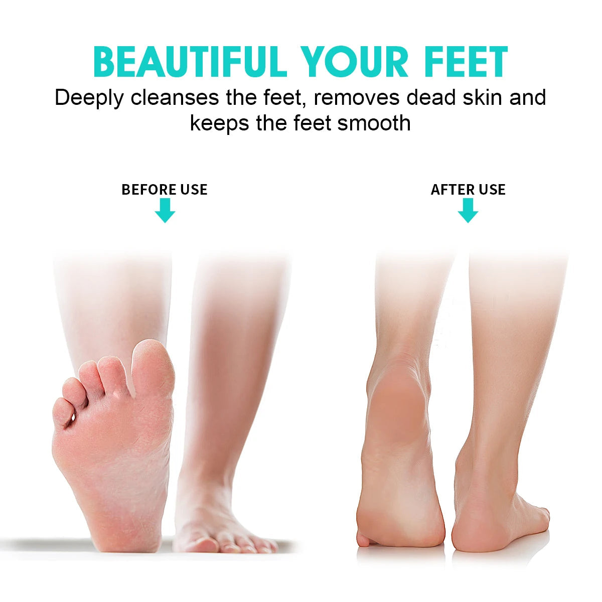 Exfoliating & Dead Skin Scrubby Towel, Travel Portable Body Bath Strips, Silicone Material ,Long Handle Back Cleanse Scrubber Nanasbeautyholic