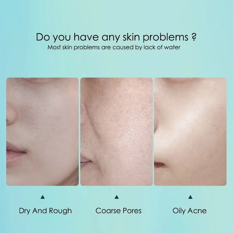 20pcs Hyaluronic Acid Collagen Face Mask skincare Moisturizing Firming Hydrating Facial Masks Sheet Mask Korean Skin Care Nanasbeautyholic