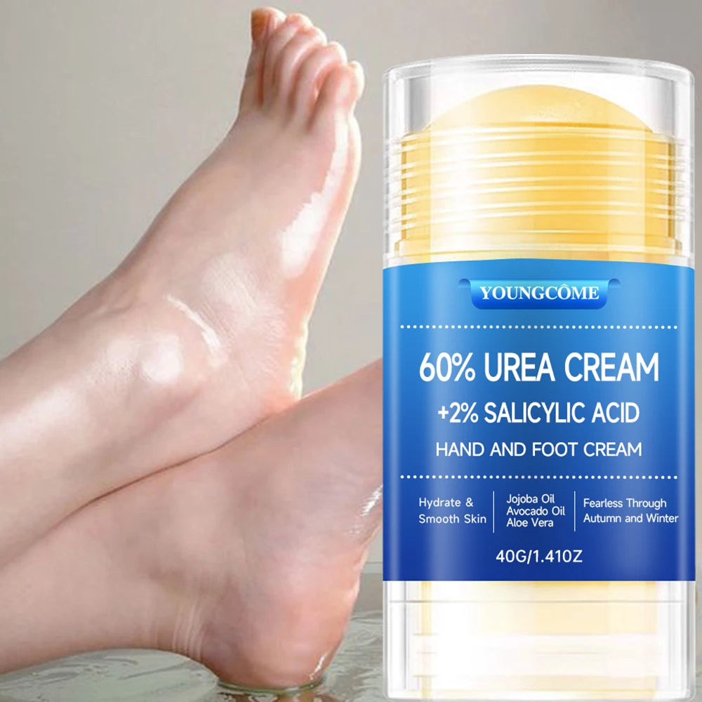 YOUNGCOME 60% Urea Foot Cream with 2% Salicylic Acid – Deep Callus Remover & Moisturizer for Dry Cracked Heels