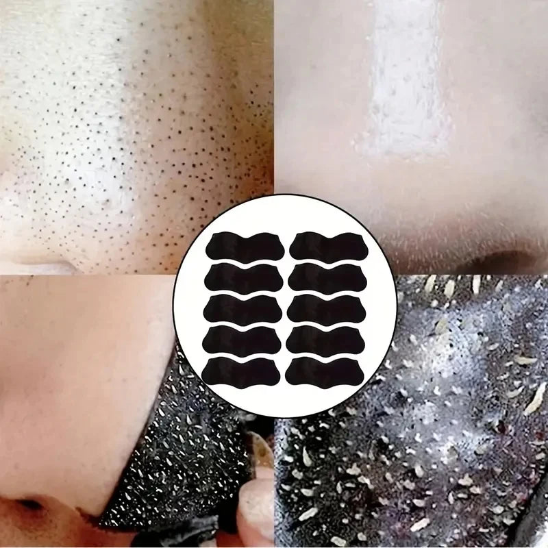 50/100PCS Bamboo Charcoal Nasal Strips Blackhead Remover