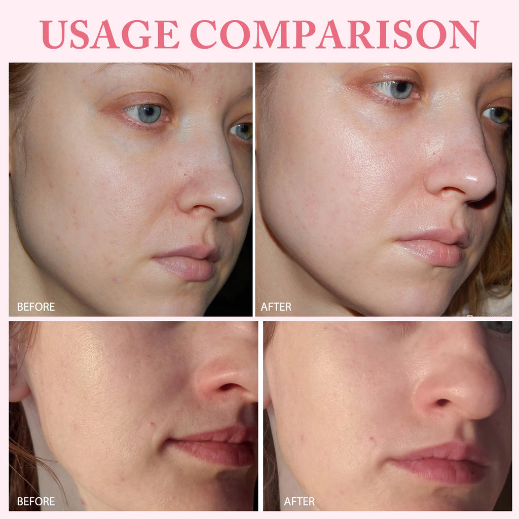 PDRN Pink One-Day Serum — Brightening, Firming & Deep Hydration Ampoules