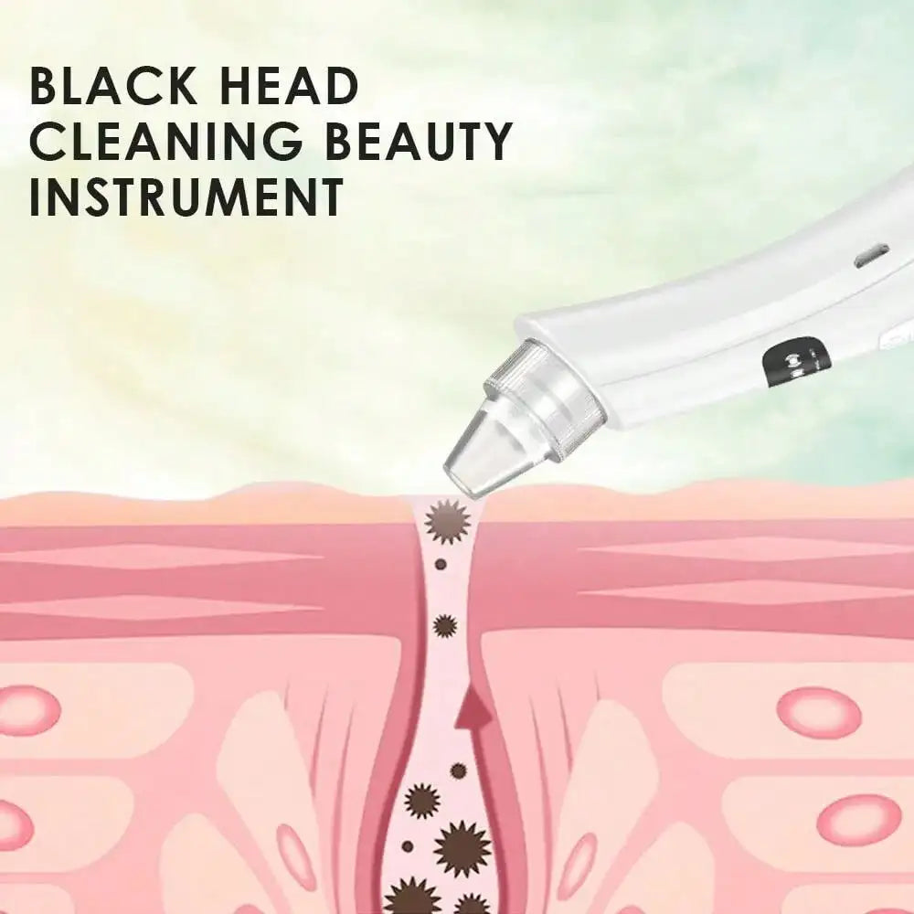 Facial Vacuum Blackhead Remover & Deep Skin Cleansing Device | 3 Suction Modes