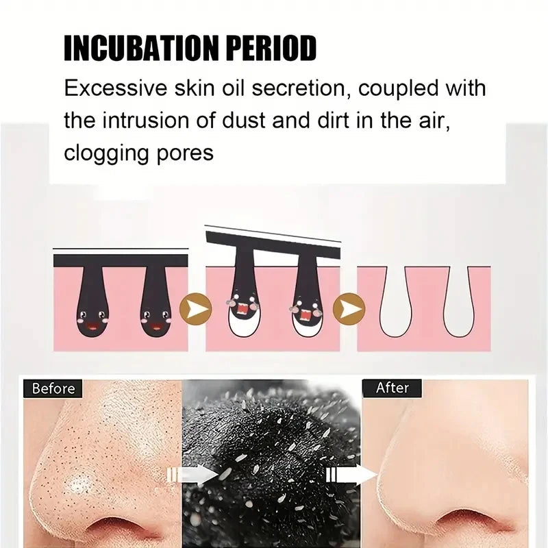 50/100PCS Bamboo Charcoal Nasal Strips Blackhead Remover