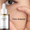 Centella Asiatica Face Serum - Soothing & Hydrating Korean Skincare