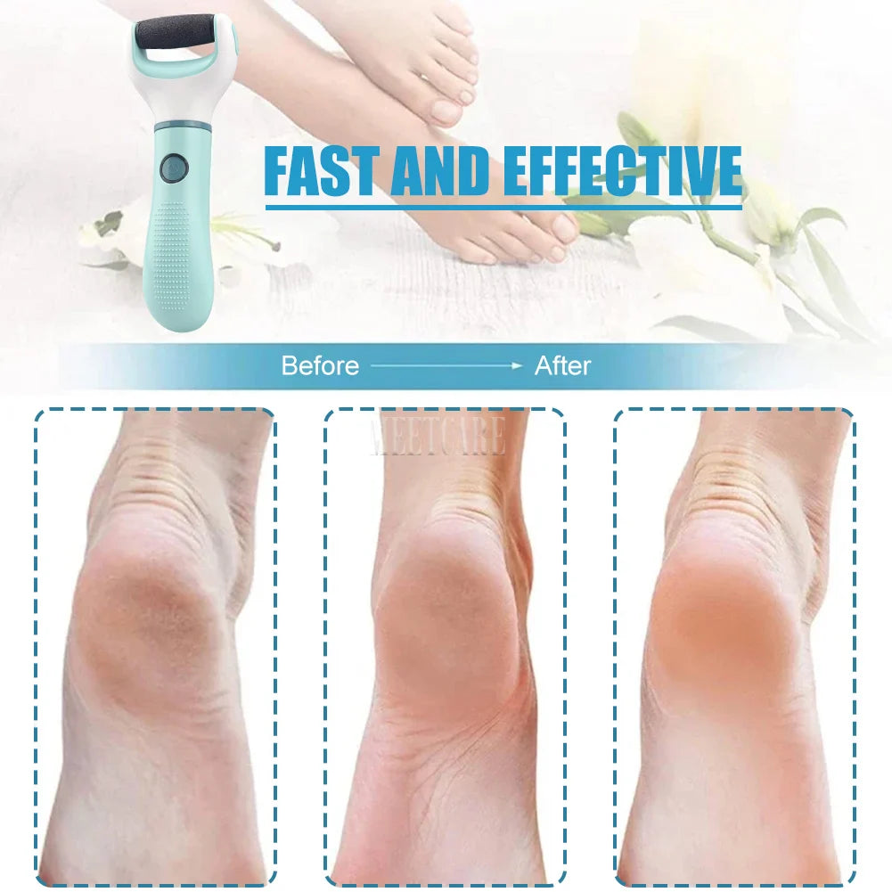 Auto Wireless Electric Foot Grinder Removal Dead Skin Calluses Cracks Hard Skin Pedicure Care Tool Waterproof Foot Cleaner ﻿ Nanasbeautyholic