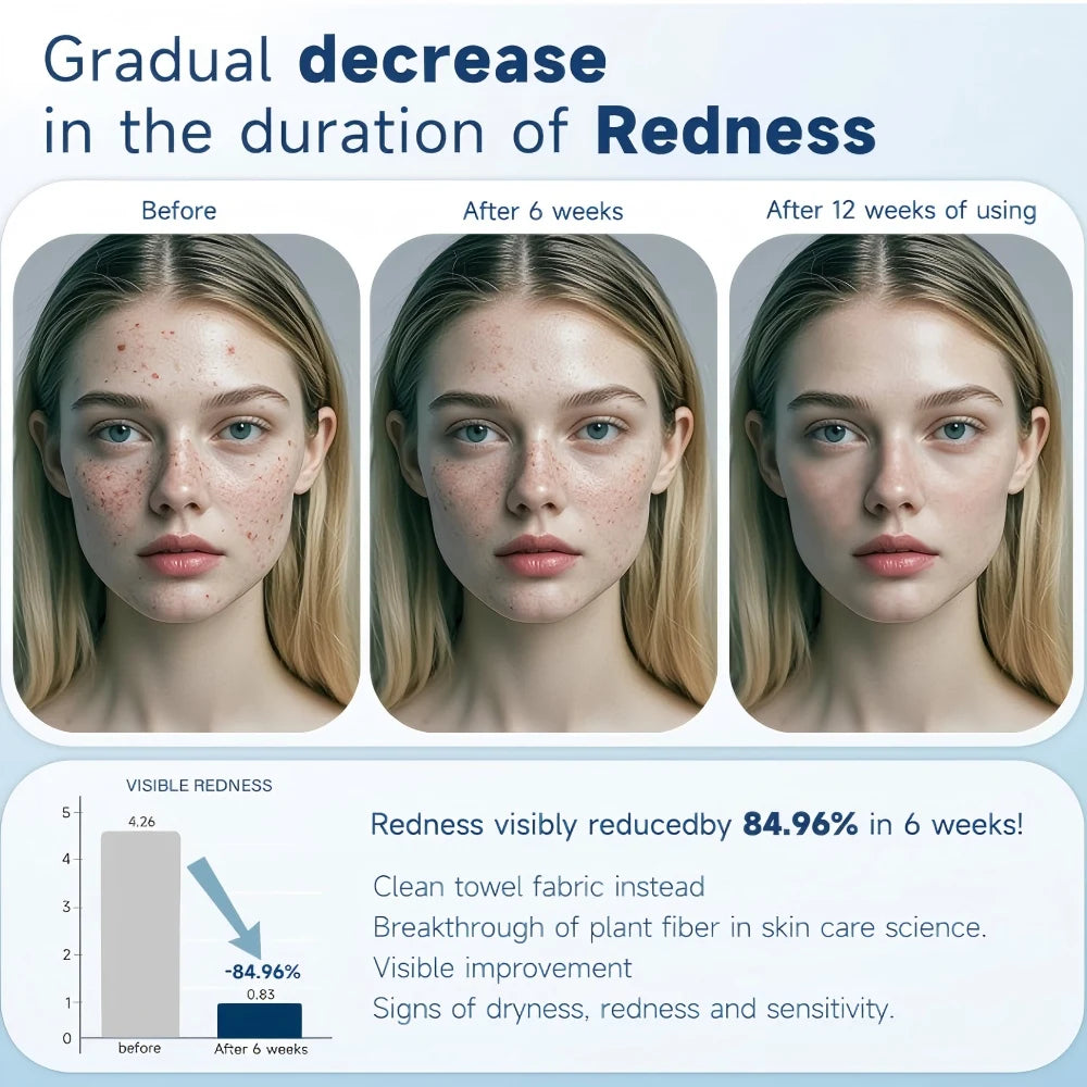 50pcs 26X30cm Thick Disposable Face Towels, Wet and Dry Use Facial Towelettes,Facial Towels for Makeup Remover Nanasbeautyholic