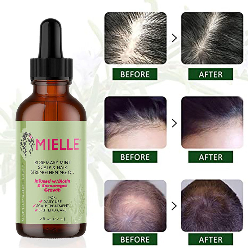 Mielle Rosemary Mint Hair Growth Oil – Biotin-Infused Strengthening Treatment for All Hair Types
